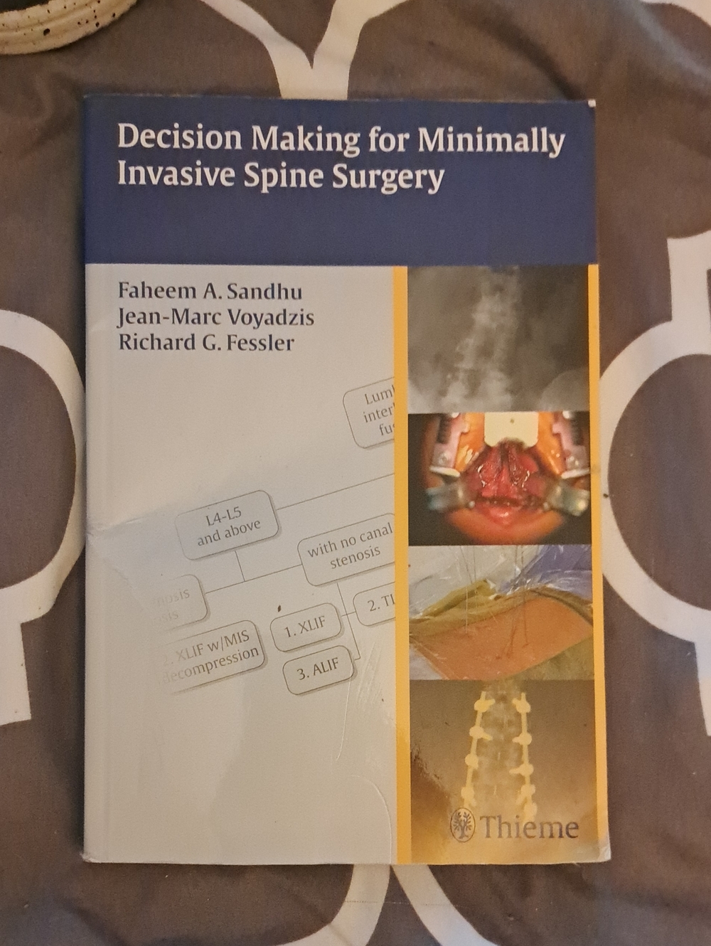 Decision Making For minimally Invasive Spine Surgery Book By Thieme